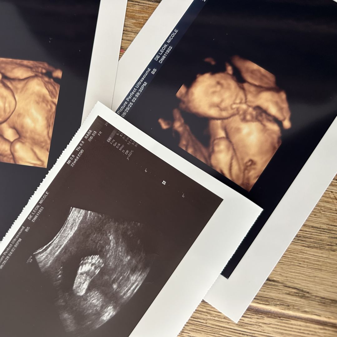 Photo shared by Nicole for their Babylist baby registry.