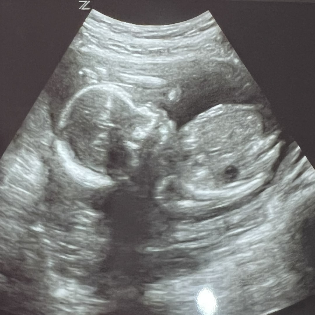 Photo shared by Lindsay for their Babylist baby registry.
