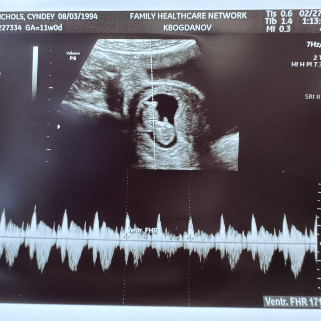 Photo shared by Cydney for their Babylist baby registry.