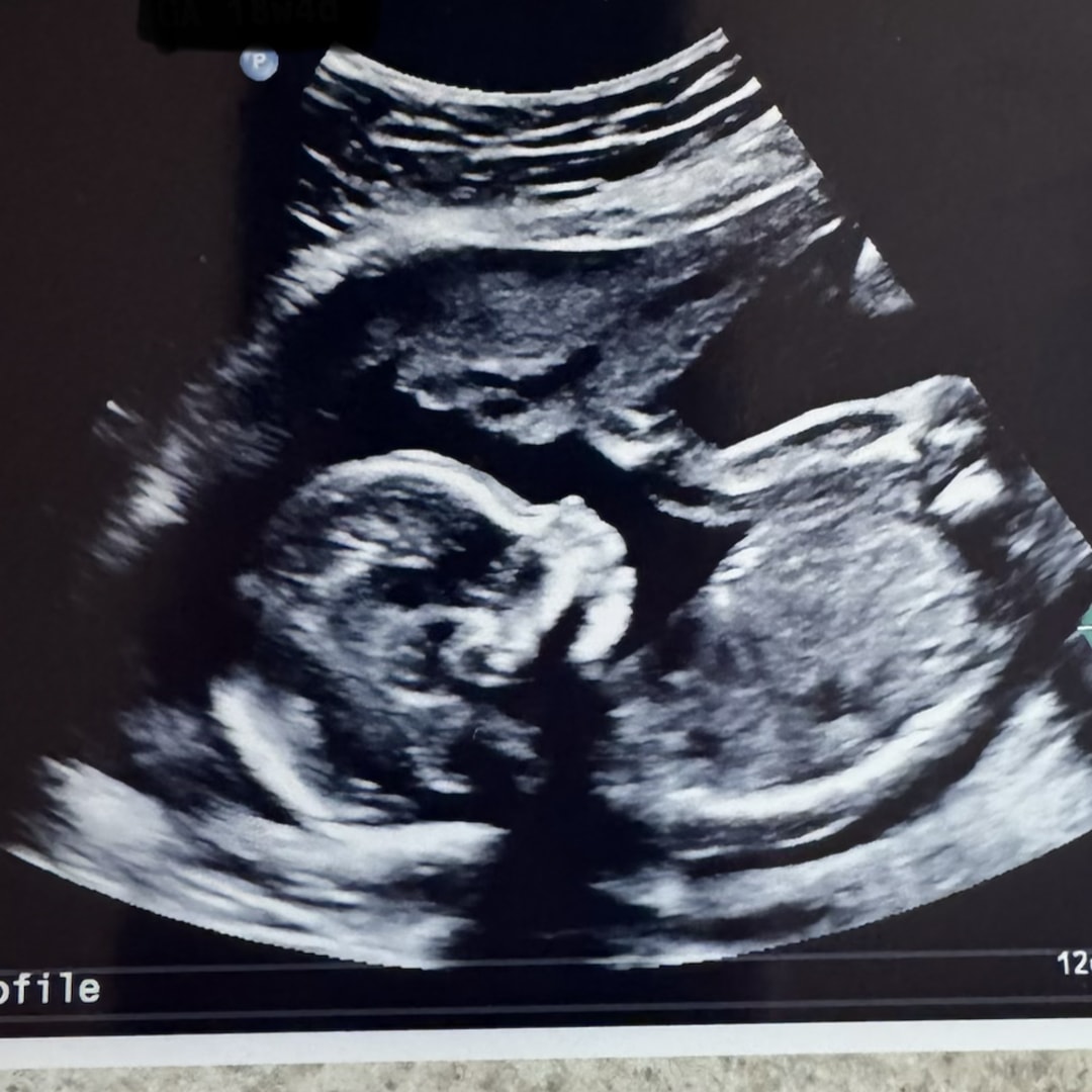 Photo shared by Jill for their Babylist baby registry.