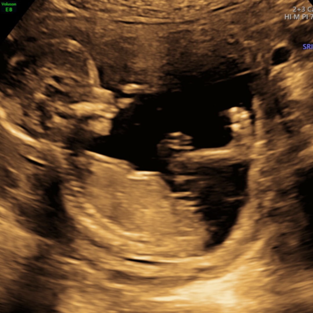 Photo shared by Jaymee for their Babylist baby registry.