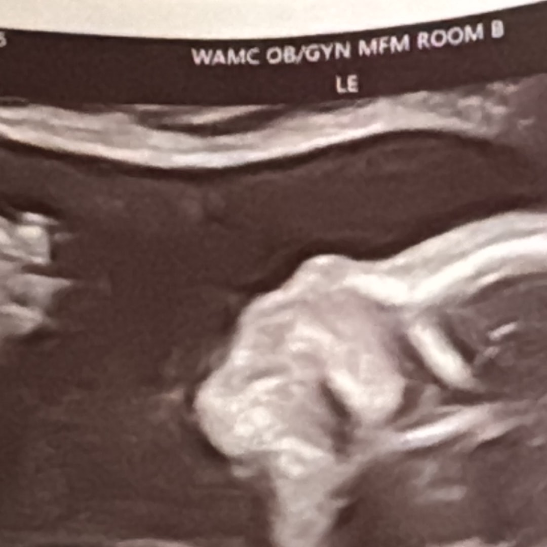 Photo shared by Karen for their Babylist baby registry.