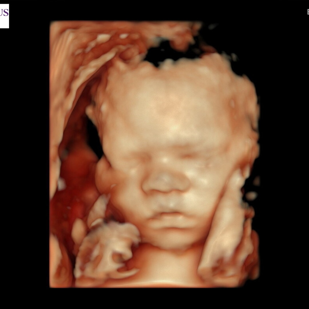Photo shared by Amy for their Babylist baby registry.