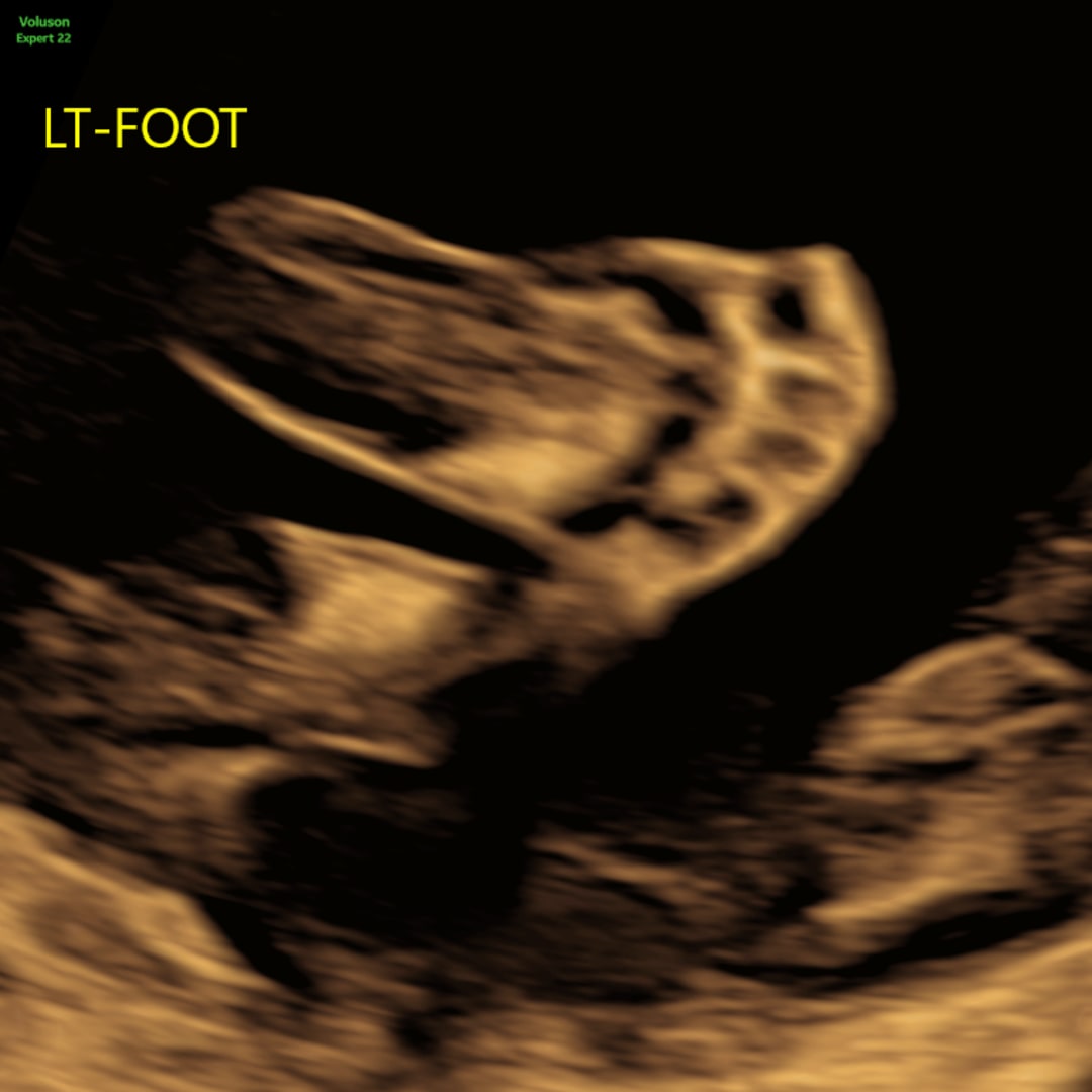 Photo shared by Kevin for their Babylist baby registry.