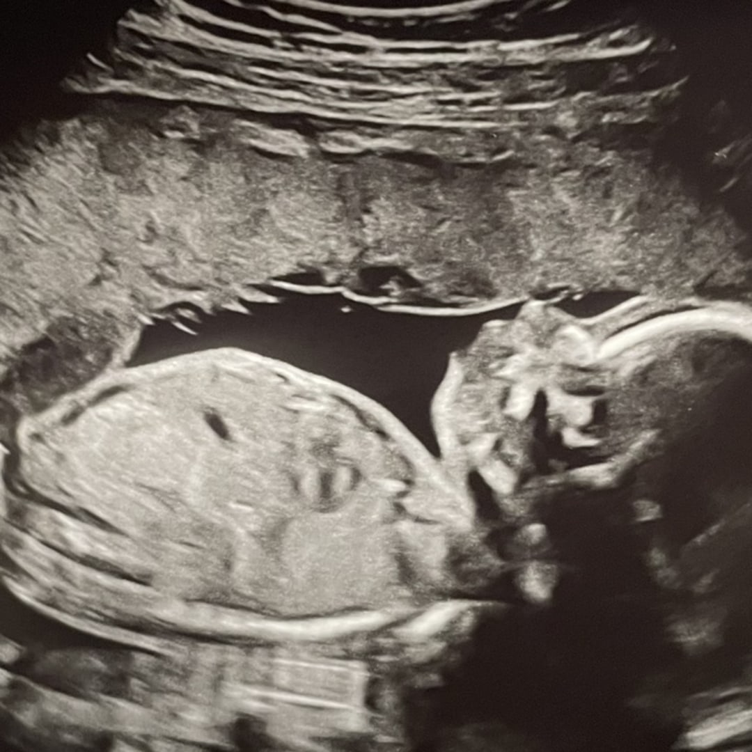 Photo shared by Dayla for their Babylist baby registry.