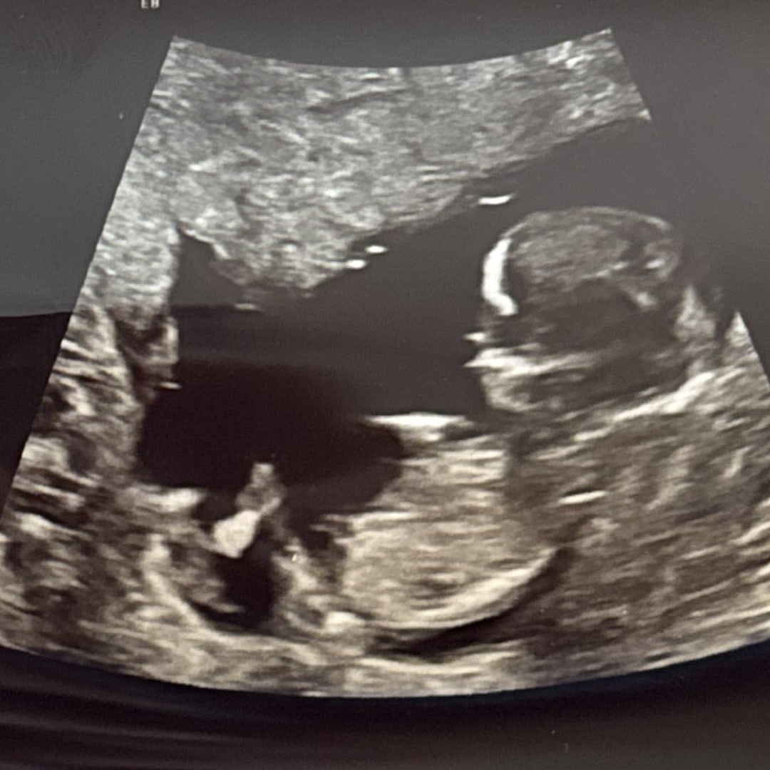 Photo shared by Victoria for their Babylist baby registry.