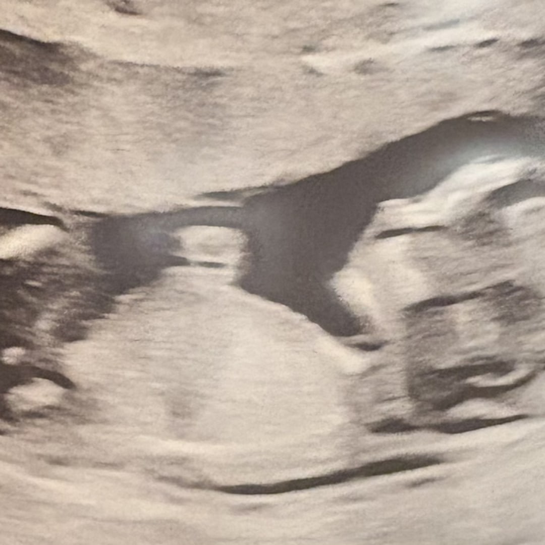 Photo shared by Felicia for their Babylist baby registry.