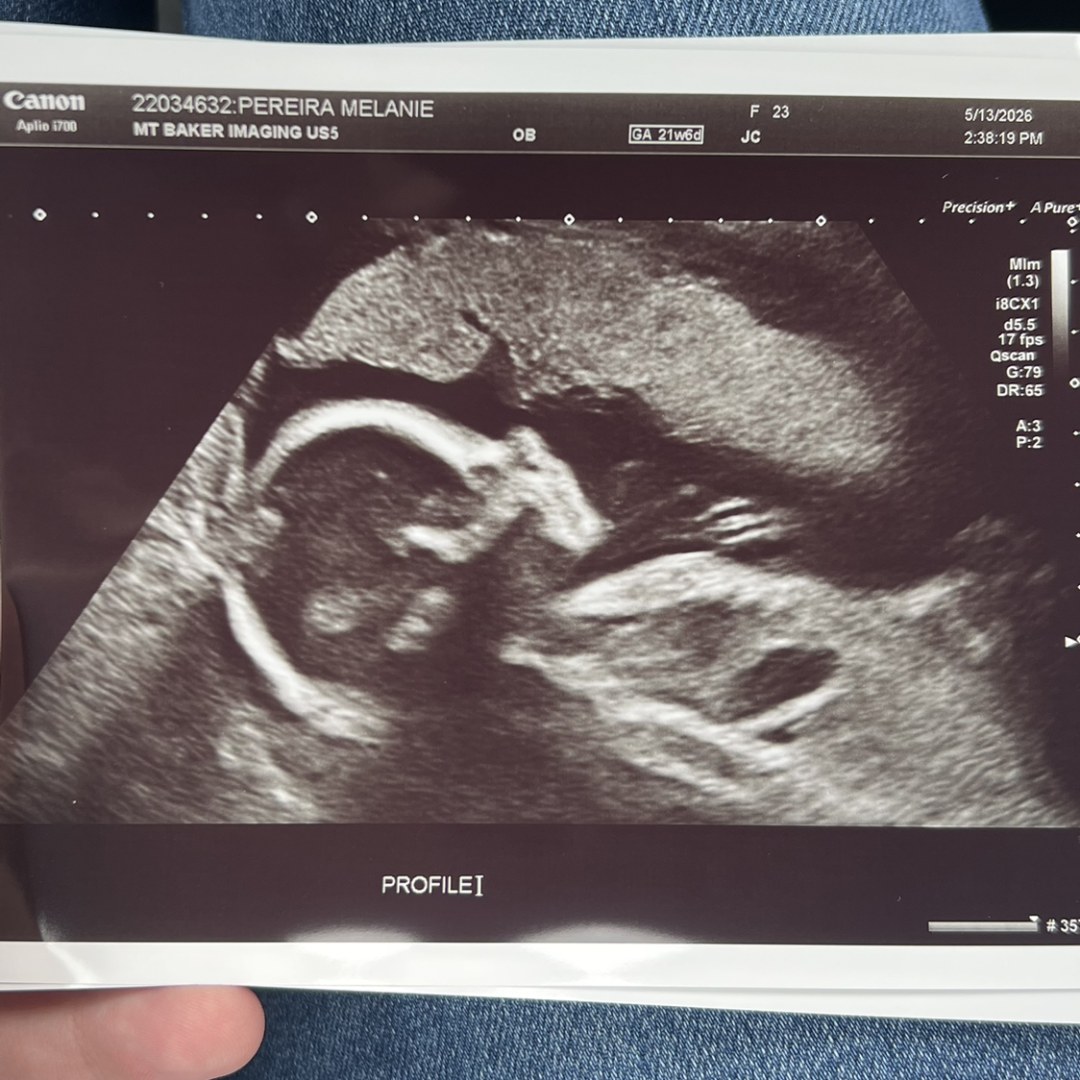 Photo shared by Melanie for their Babylist baby registry.