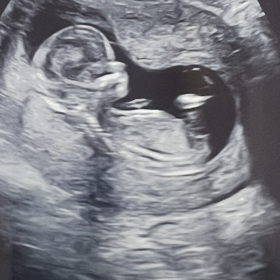 Photo shared by Sarah for their Babylist baby registry.
