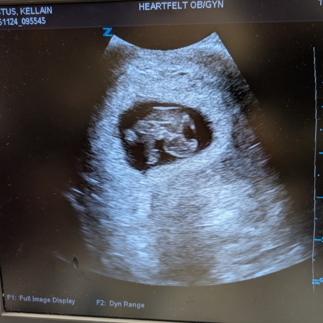 Photo shared by Laney for their Babylist baby registry.