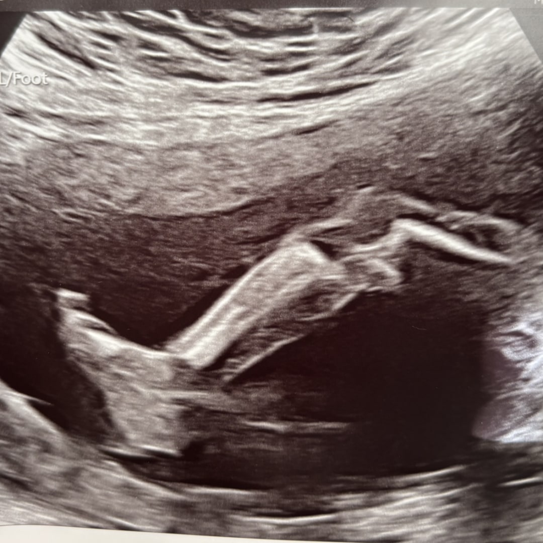 Photo shared by Haley for their Babylist baby registry.