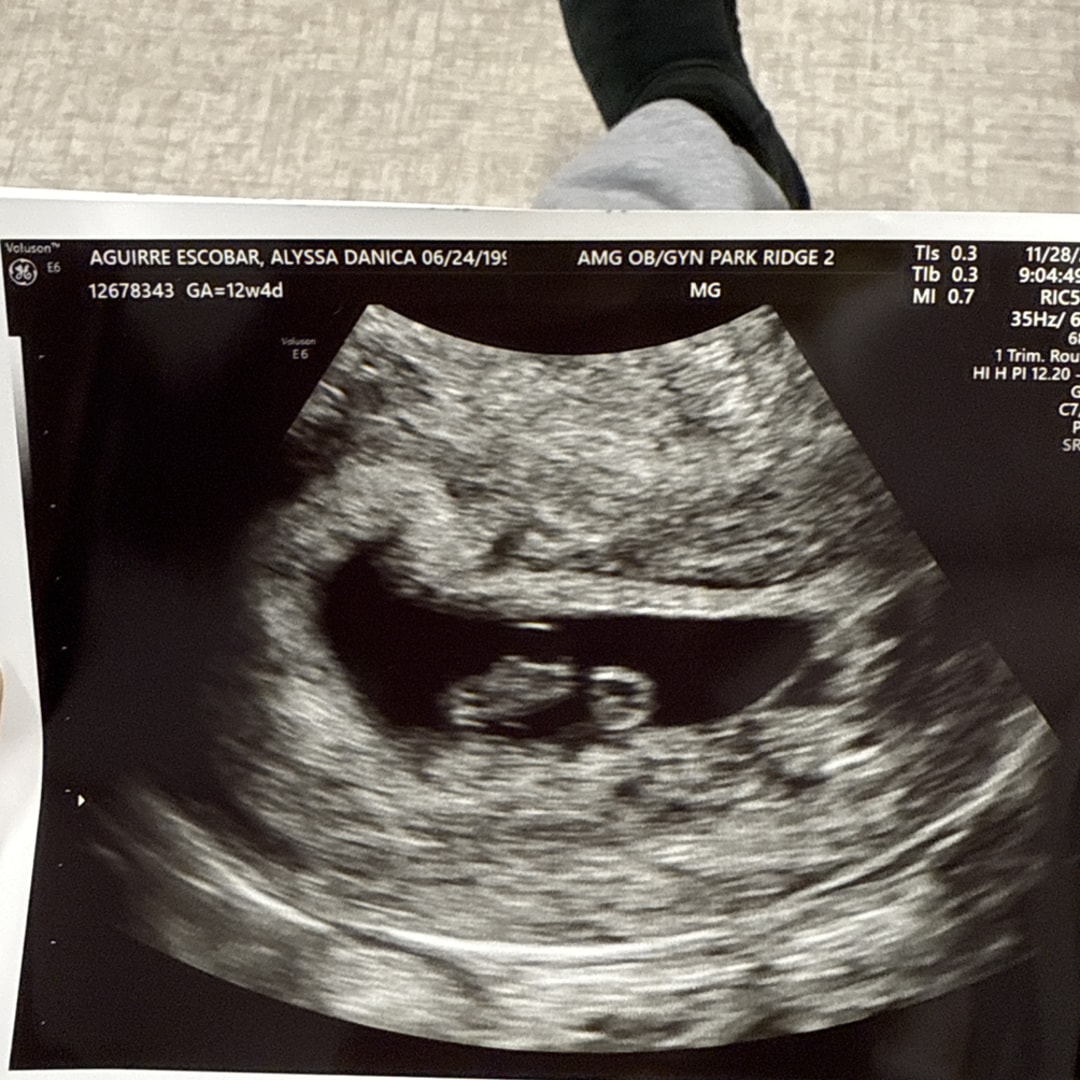 Photo shared by Alyssa for their Babylist baby registry.