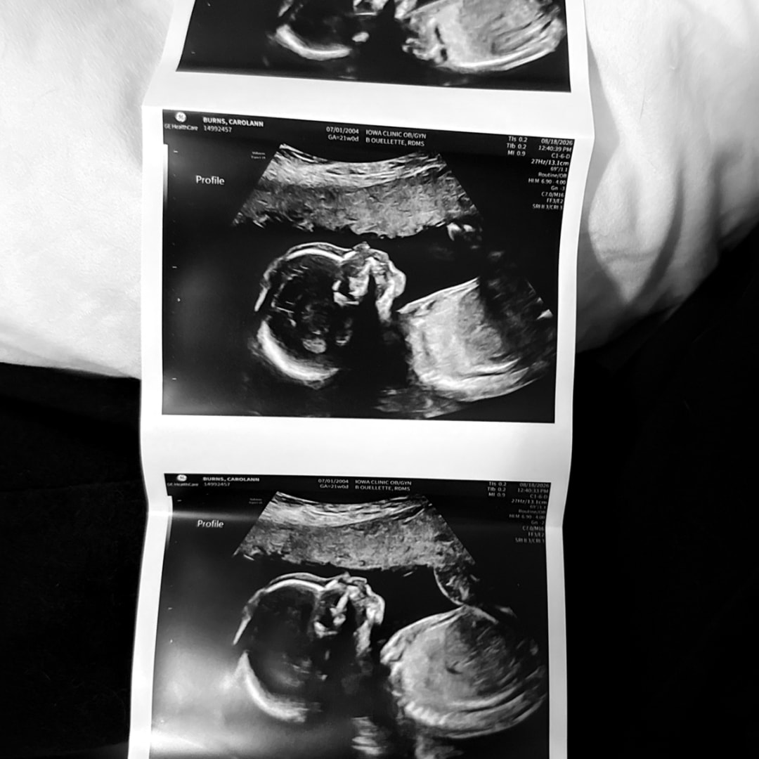 Photo shared by Carol Ann for their Babylist baby registry.