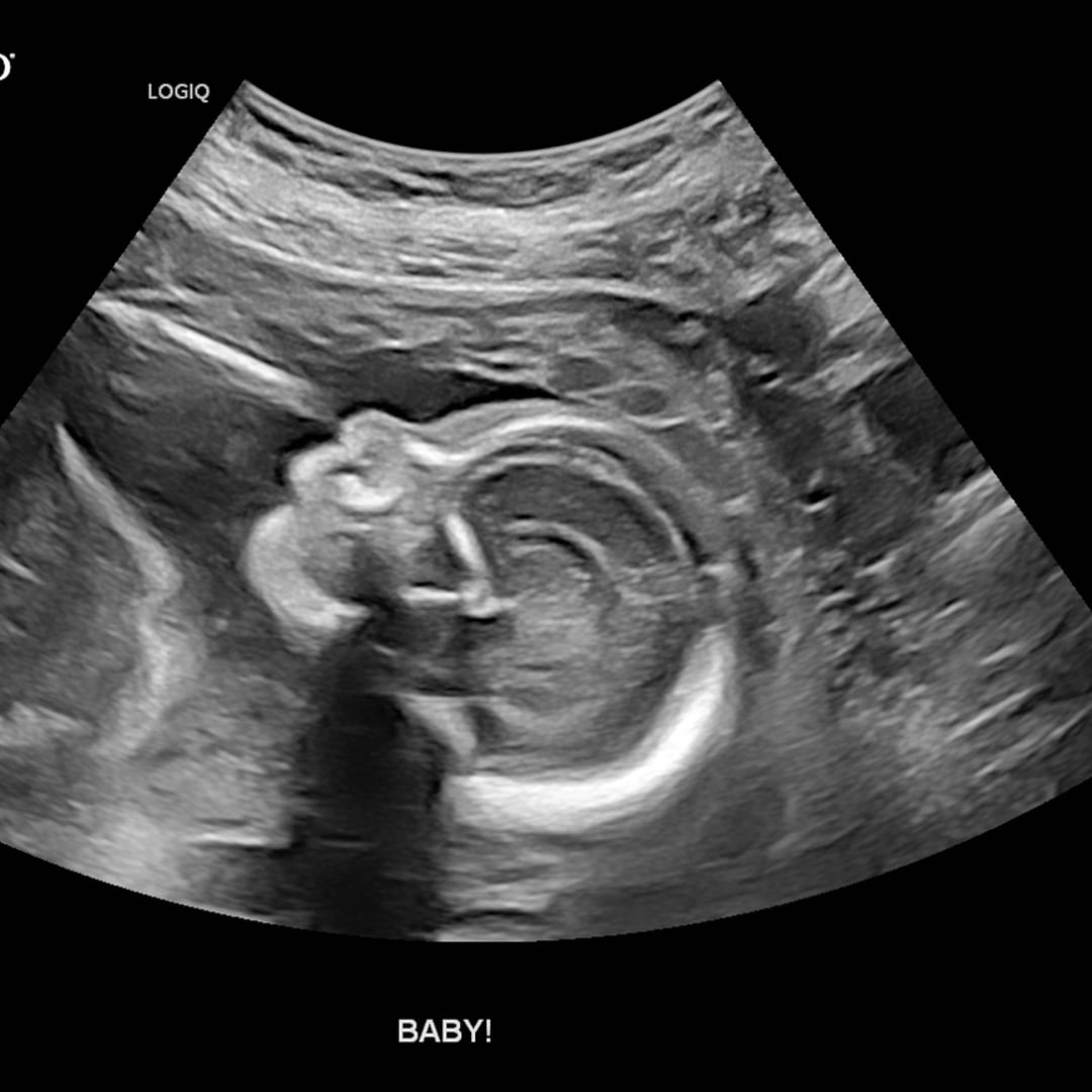 Photo shared by Cherstin for their Babylist baby registry.