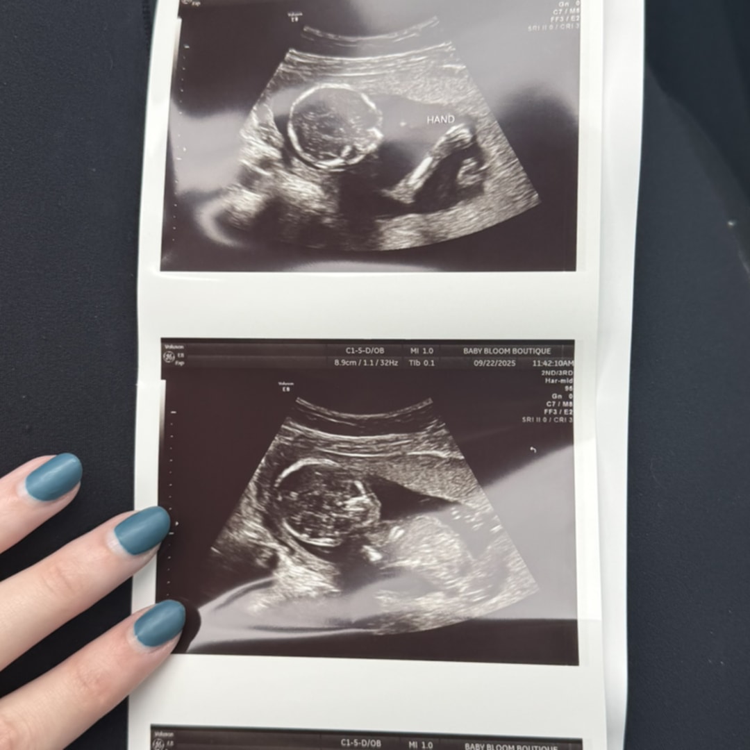 Photo shared by Ashli for their Babylist baby registry.