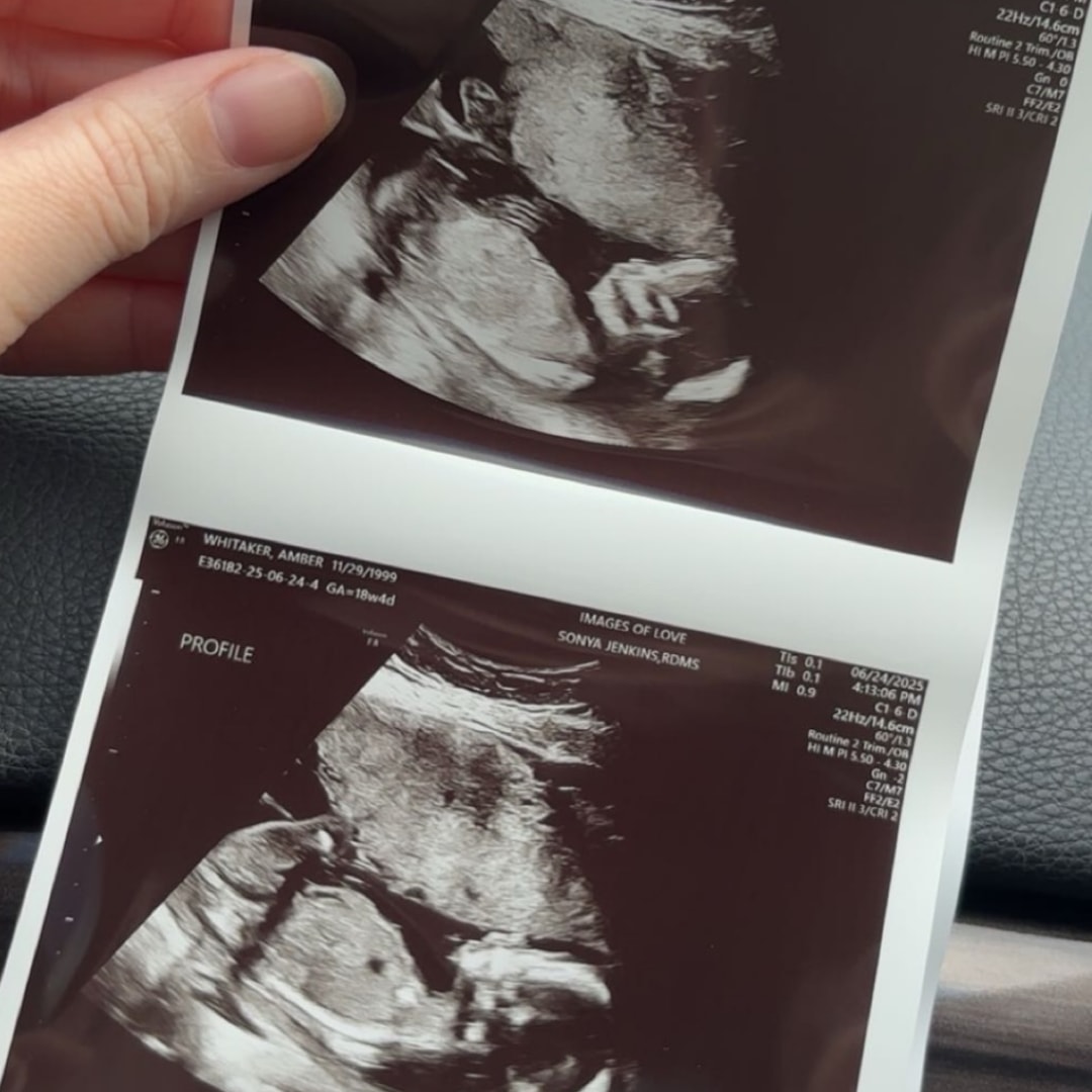 Photo shared by Amber for their Babylist baby registry.