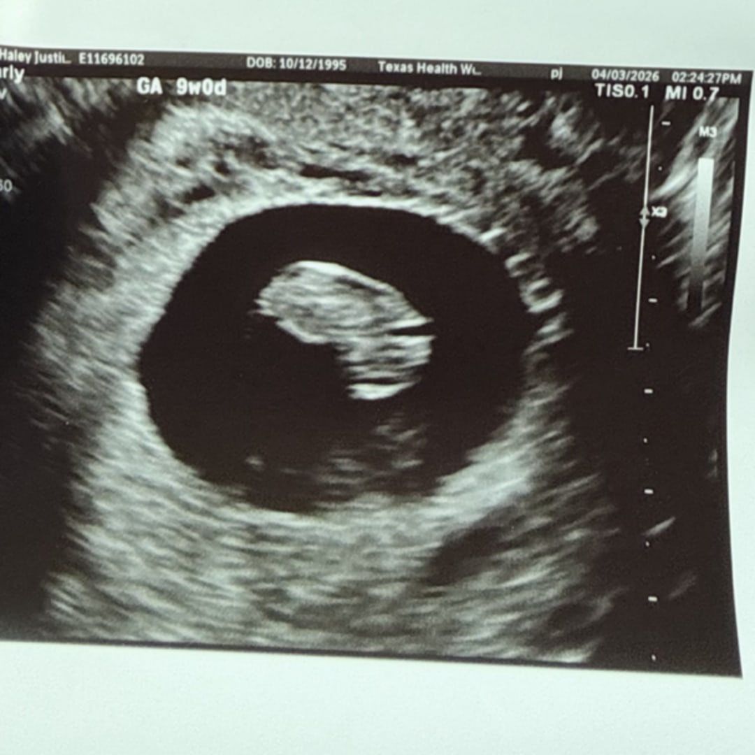 Photo shared by Haley for their Babylist baby registry.