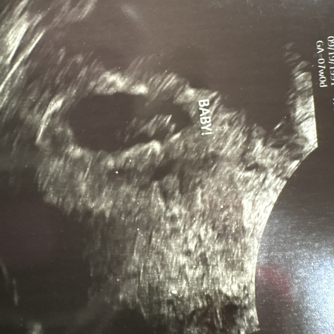 Photo shared by Dacia for their Babylist baby registry.