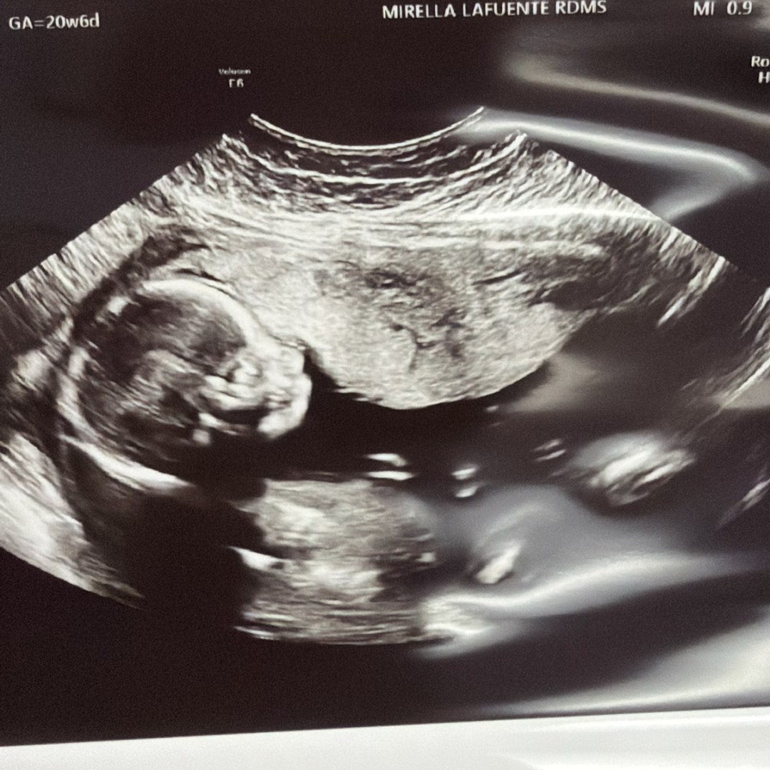 Photo shared by Cadence for their Babylist baby registry.