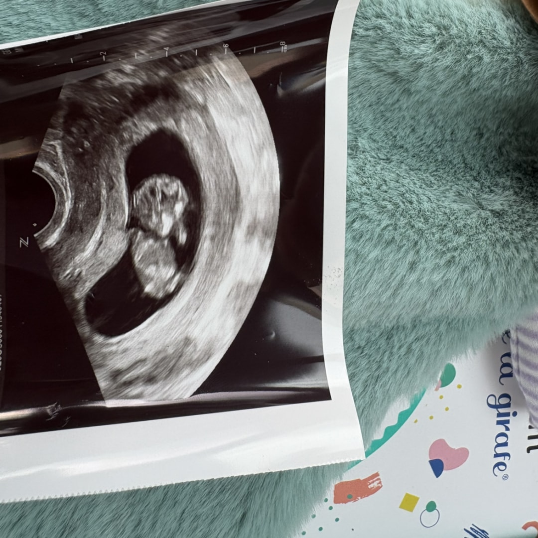 Photo shared by Champel for their Babylist baby registry.