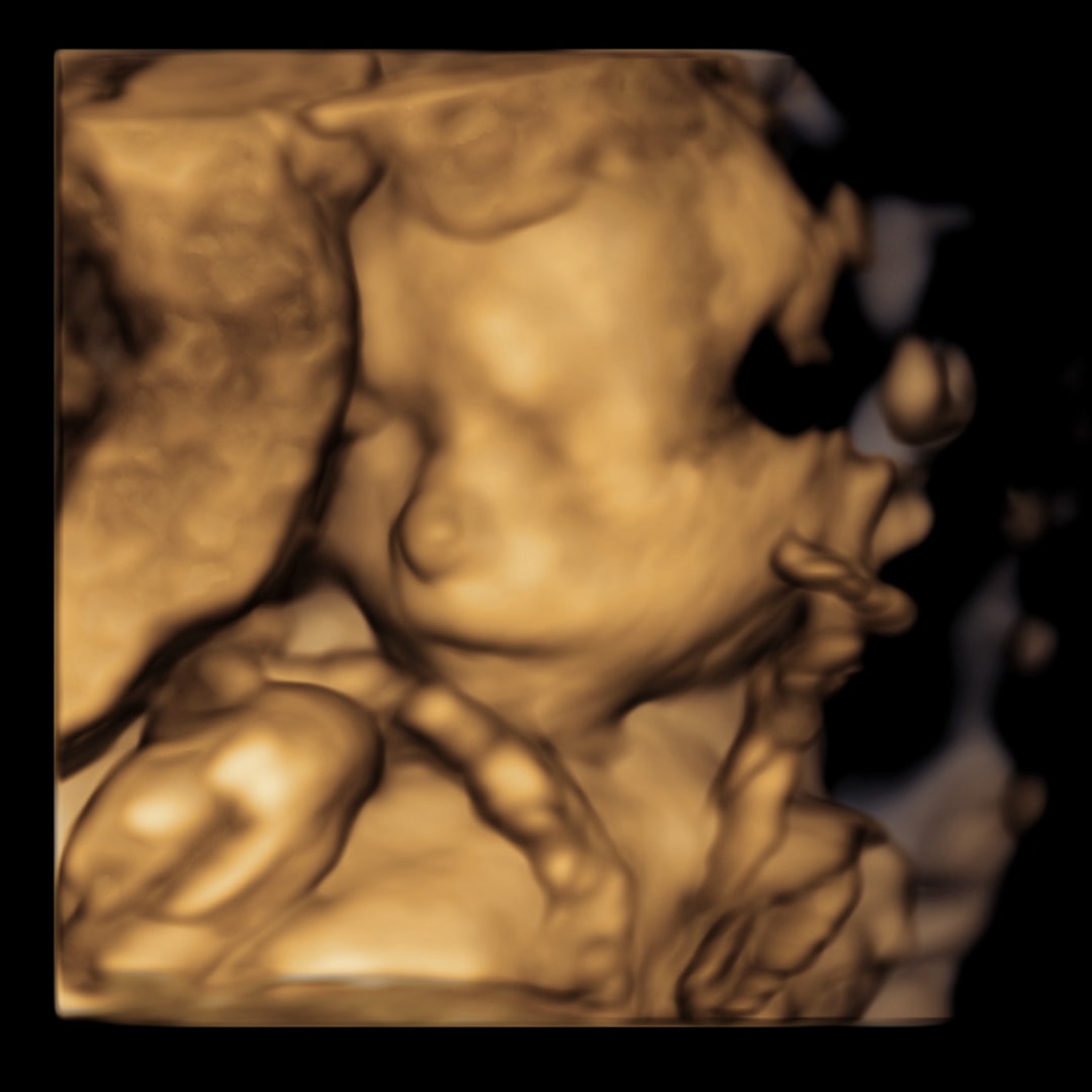 Photo shared by Trinity for their Babylist baby registry.