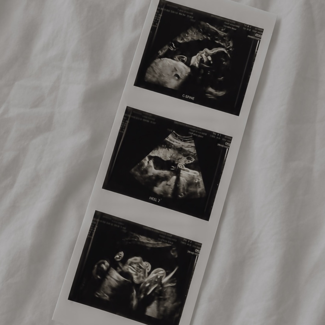 Photo shared by Diamond for their Babylist baby registry.