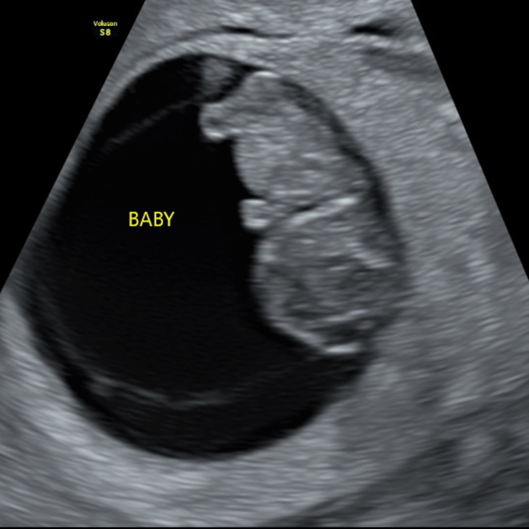 Photo shared by Jill for their Babylist baby registry.