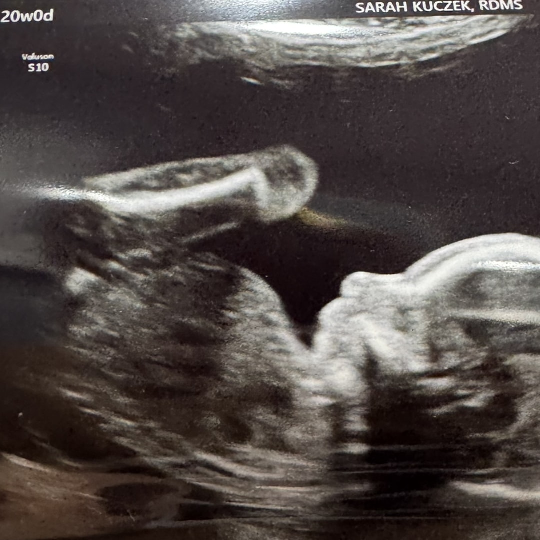 Photo shared by McKenzie for their Babylist baby registry.