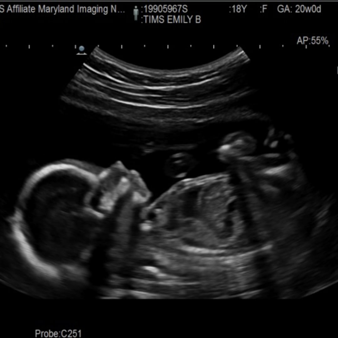 Photo shared by Emily for their Babylist baby registry.