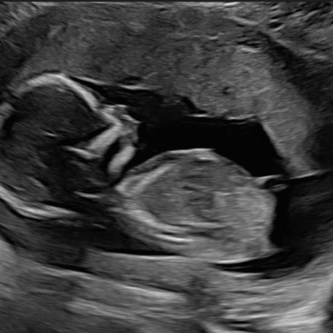 Photo shared by Rachel for their Babylist baby registry.