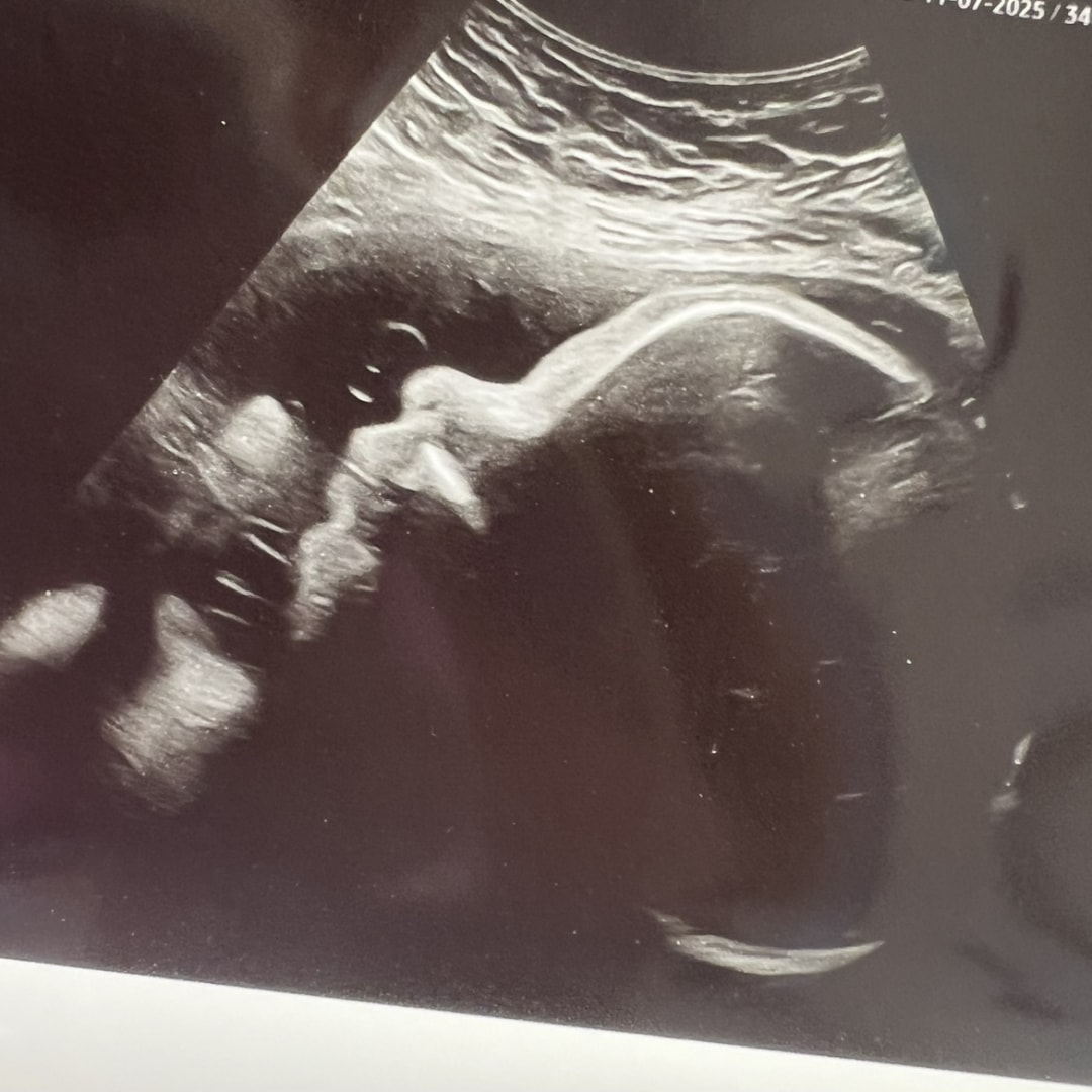 Photo shared by Katie for their Babylist baby registry.