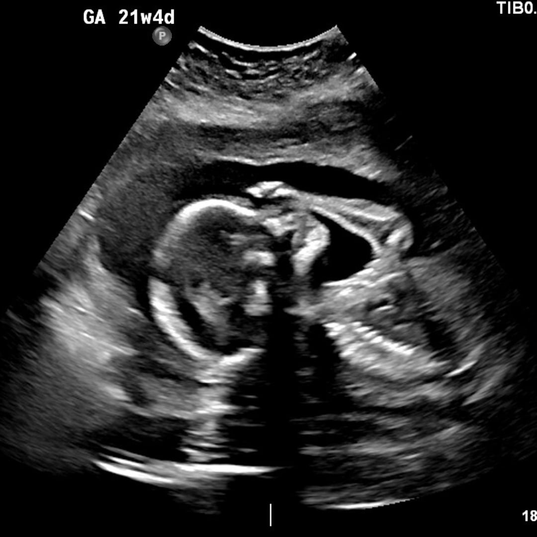 Photo shared by Hannah for their Babylist baby registry.