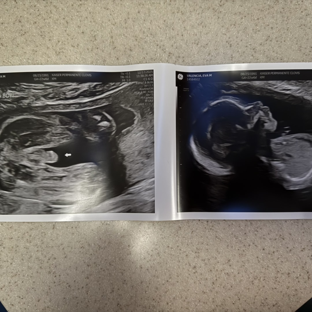 Photo shared by Eva for their Babylist baby registry.