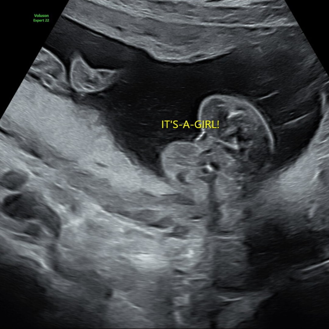 Photo shared by Kay for their Babylist baby registry.