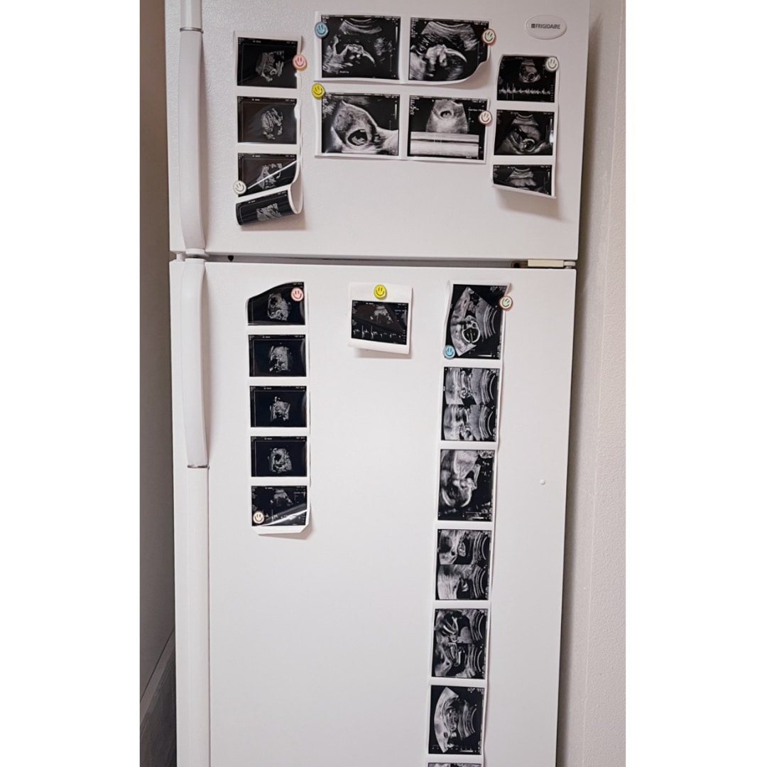 Photo shared by Elyse for their Babylist baby registry.