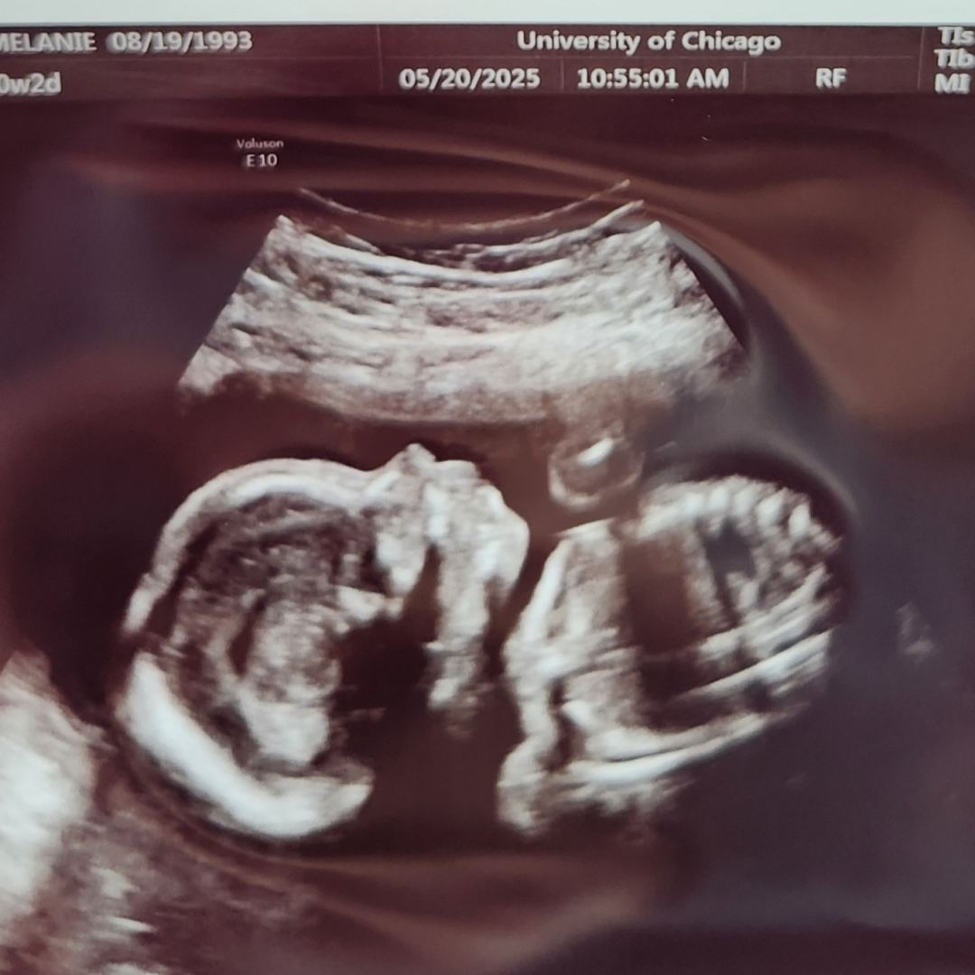 Photo shared by Melanie for their Babylist baby registry.