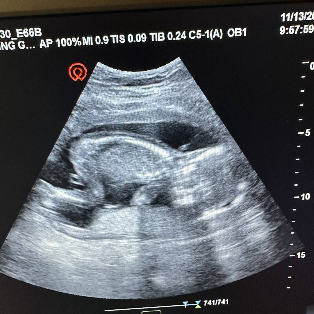 Photo shared by Aeisha for their Babylist baby registry.