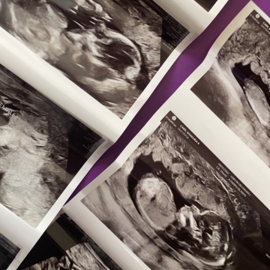 Photo shared by Shakuria for their Babylist baby registry.