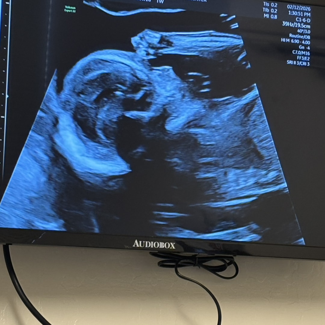 Photo shared by Christine for their Babylist baby registry.