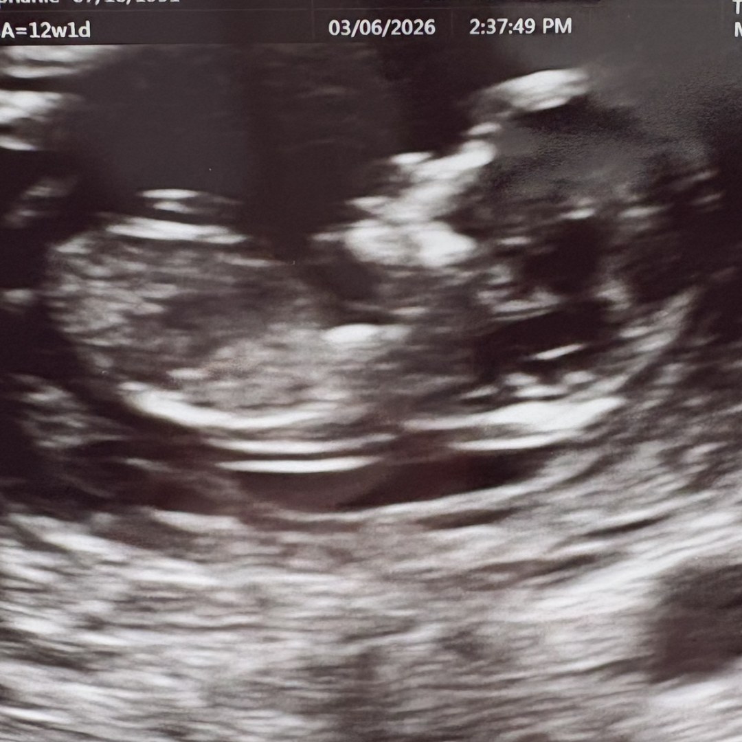 Photo shared by Stephanie for their Babylist baby registry.