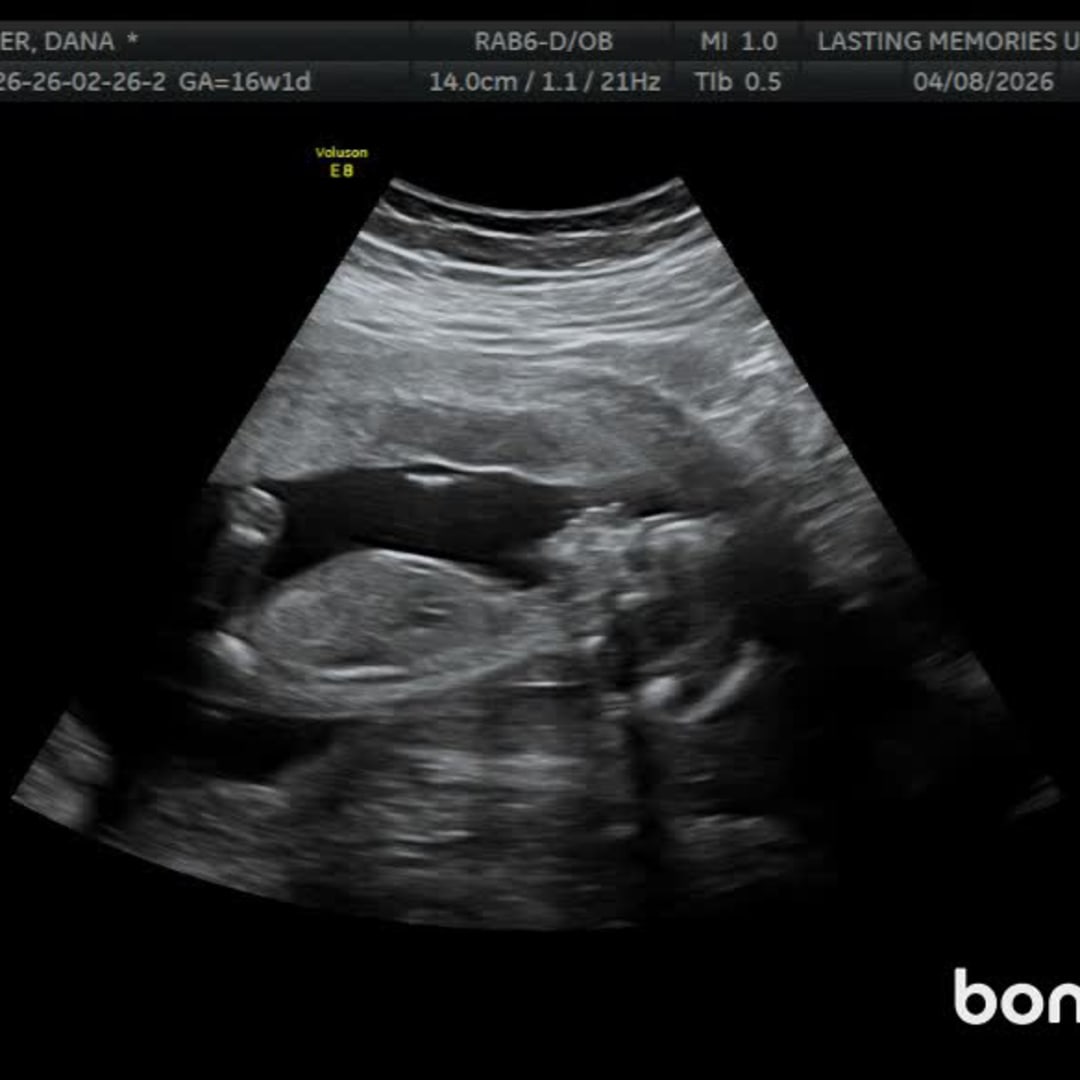 Photo shared by Dana for their Babylist baby registry.