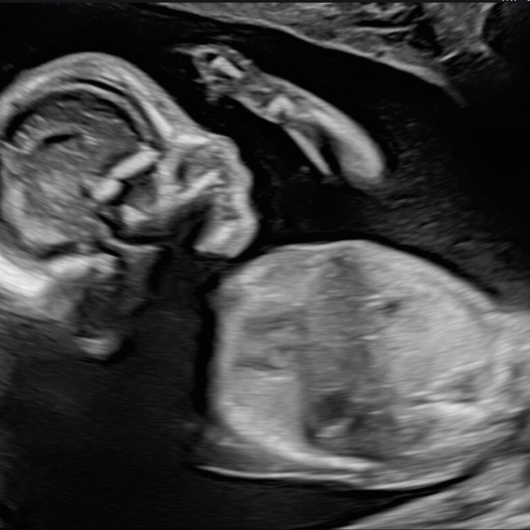 Photo shared by Samantha for their Babylist baby registry.