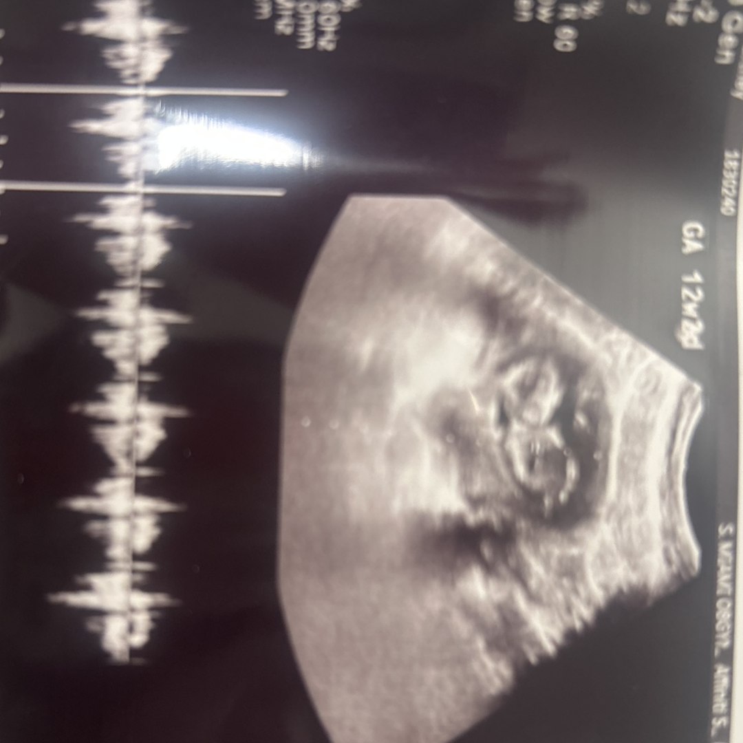 Photo shared by Courtney for their Babylist baby registry.