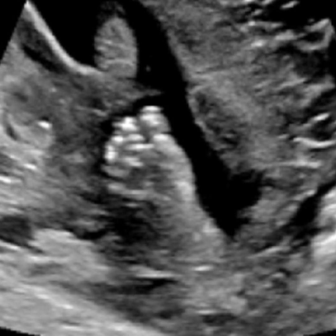 Photo shared by Caitlin for their Babylist baby registry.