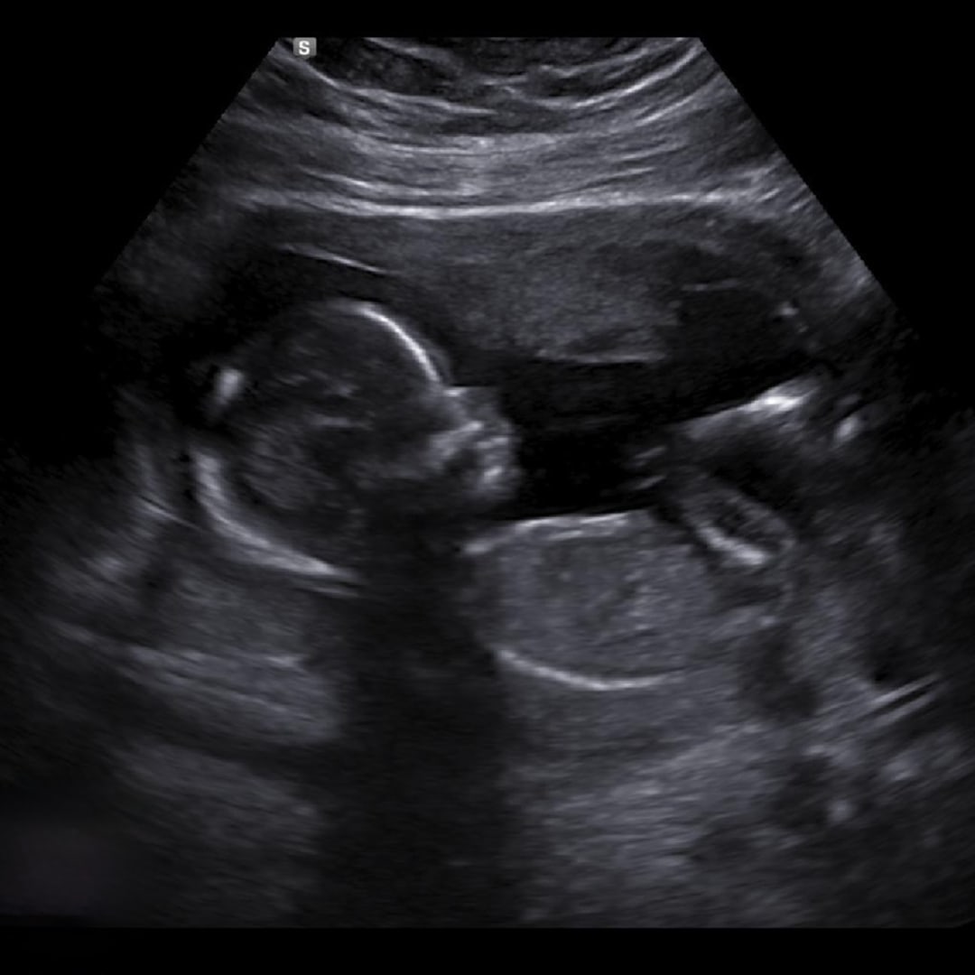 Photo shared by Ashley for their Babylist baby registry.