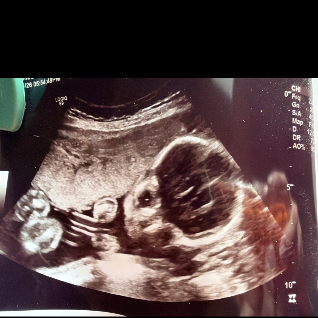 Photo shared by Amanda for their Babylist baby registry.