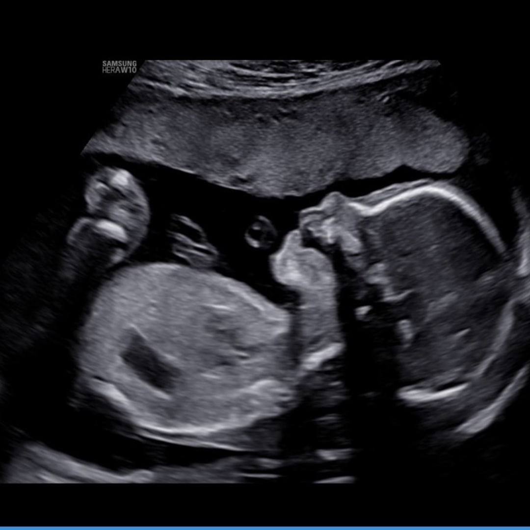 Photo shared by Dayany for their Babylist baby registry.