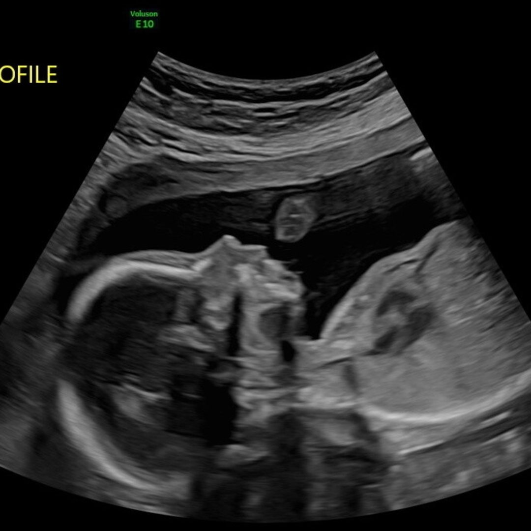 Photo shared by Laura for their Babylist baby registry.