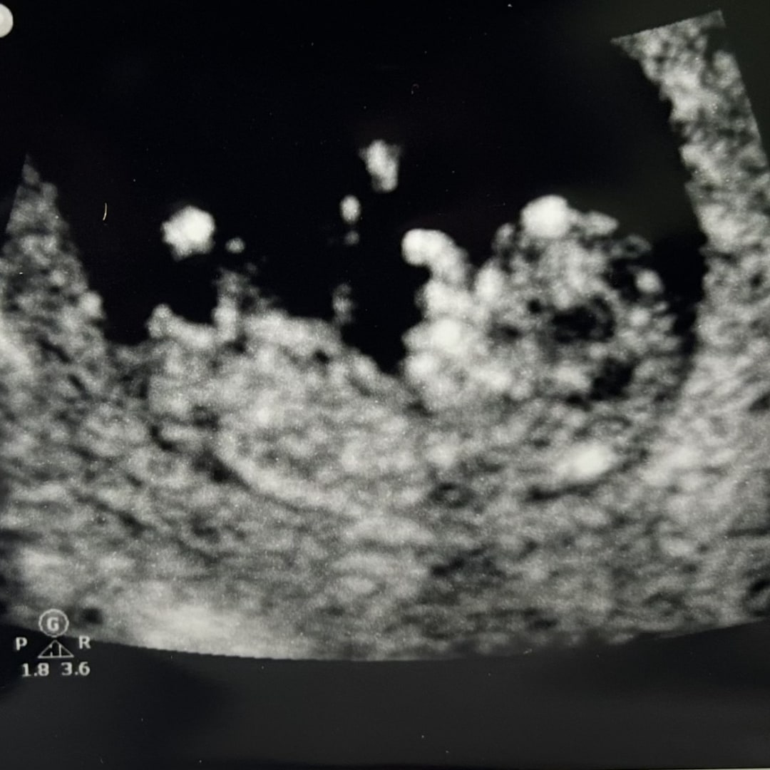 Photo shared by Darrien for their Babylist baby registry.