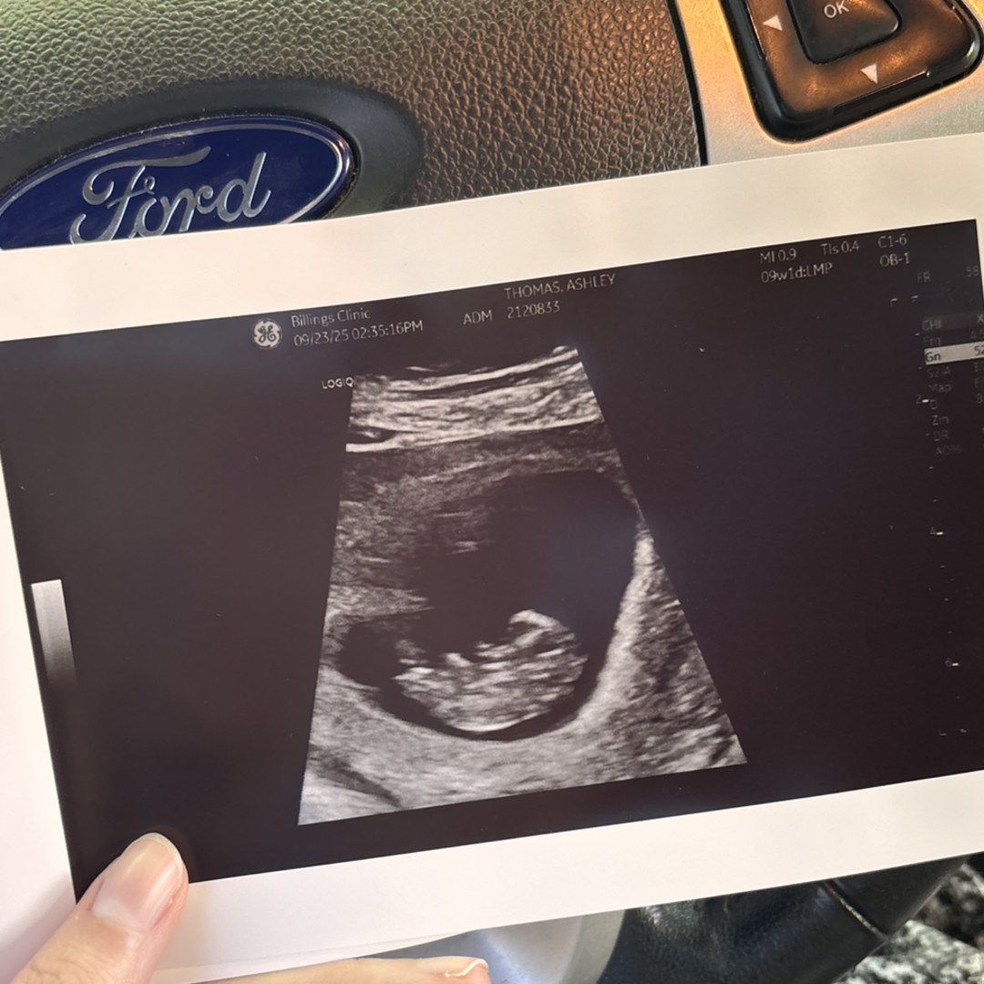 Photo shared by Ashley for their Babylist baby registry.